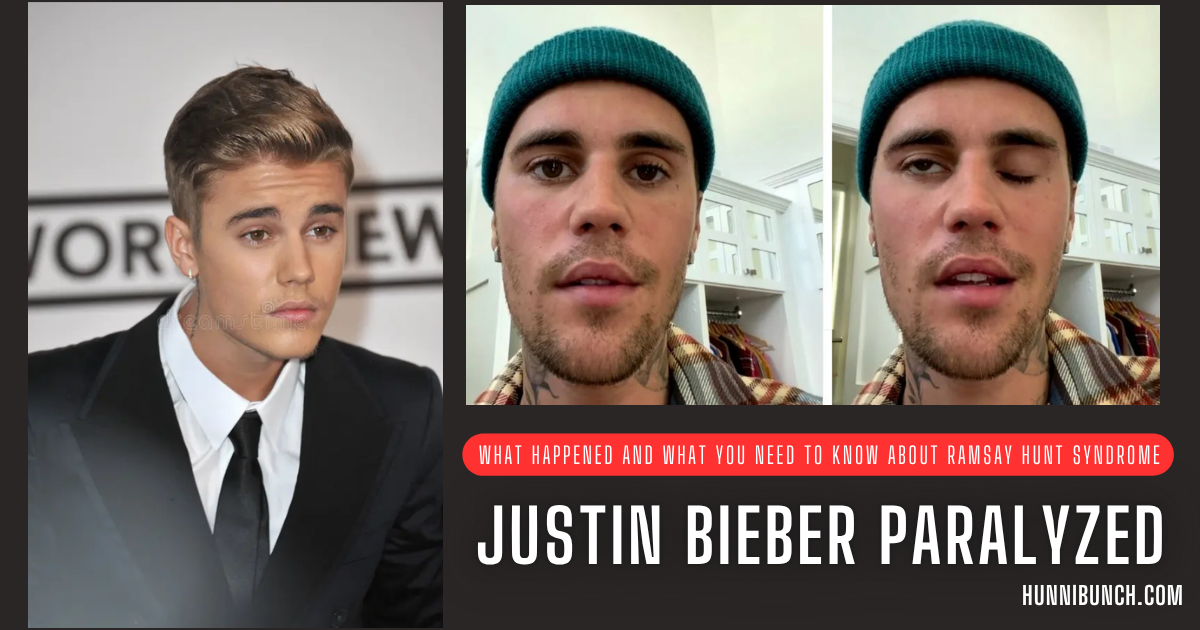 Justin Bieber Paralyzed: What Happened and What You Need to Know About Ramsay Hunt Syndrome